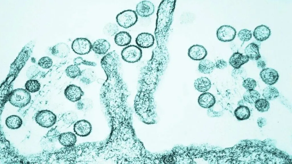 Especialistas monitorean casos de hantavirus tras brote detectado en pasajeros de un crucero internacional