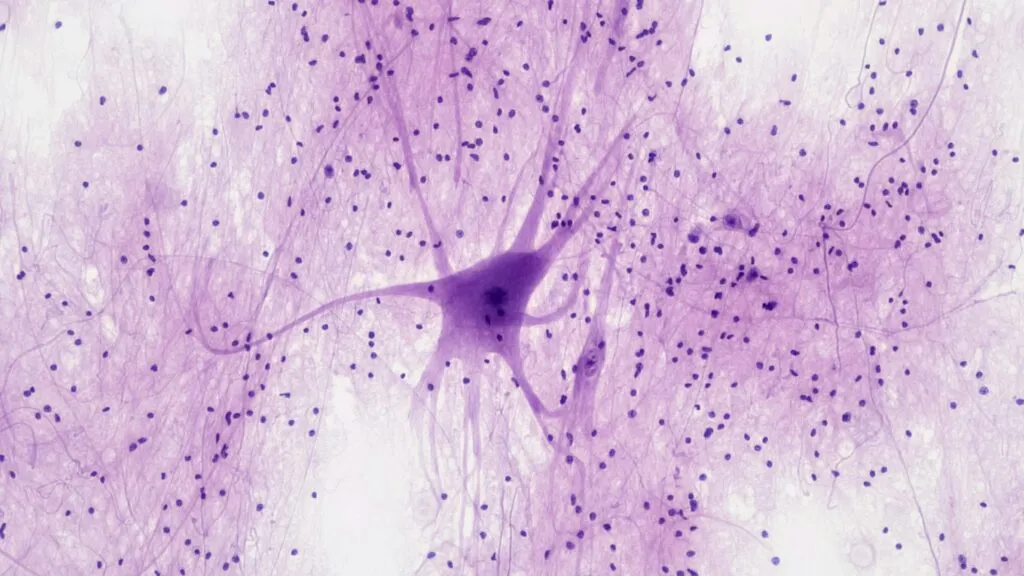 Representación científica de neuronas y conexiones cerebrales analizadas por investigadores de Yale