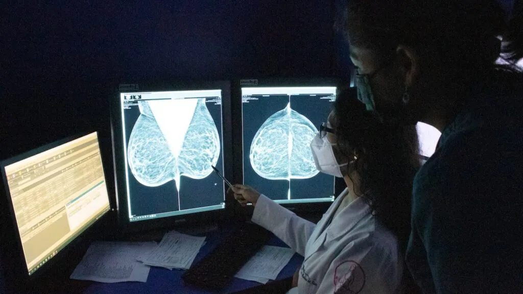 Especialistas de Yale analizan cómo la mastografía digital y la inteligencia artificial fortalecen la detección del cáncer de mama.