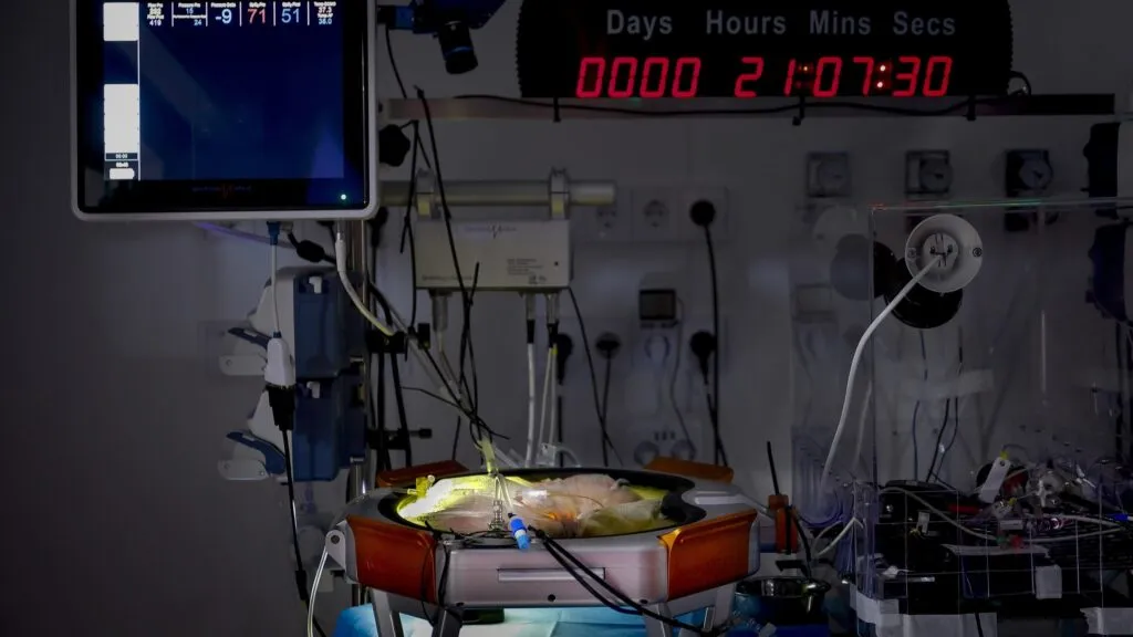 Avances en el desarrollo de una placenta artificial para mejorar la atención de bebés extremadamente prematuros.