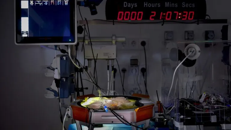 Avances en el desarrollo de una placenta artificial para mejorar la atención de bebés extremadamente prematuros.