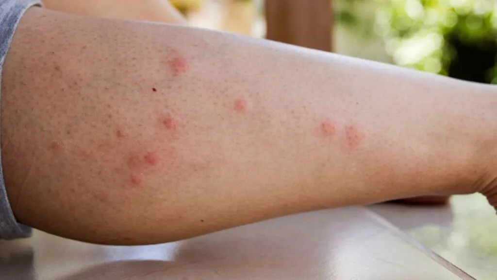 Los mosquitos utilizan dióxido de carbono, calor corporal, microbiota y señales químicas para identificar a las personas más atractivas.