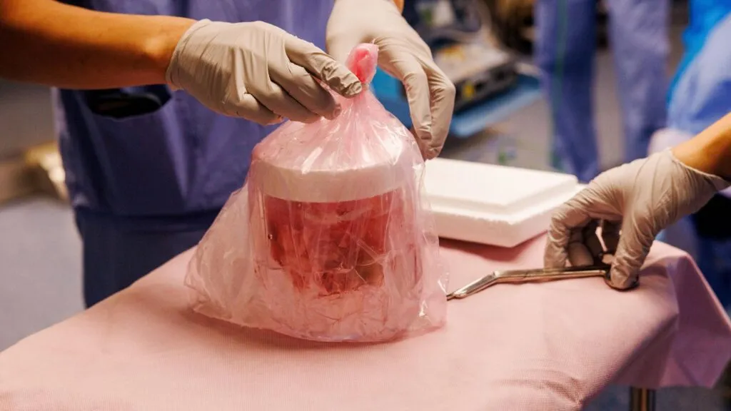 Riñón de cerdo modificado genéticamente para un xenotrasplante